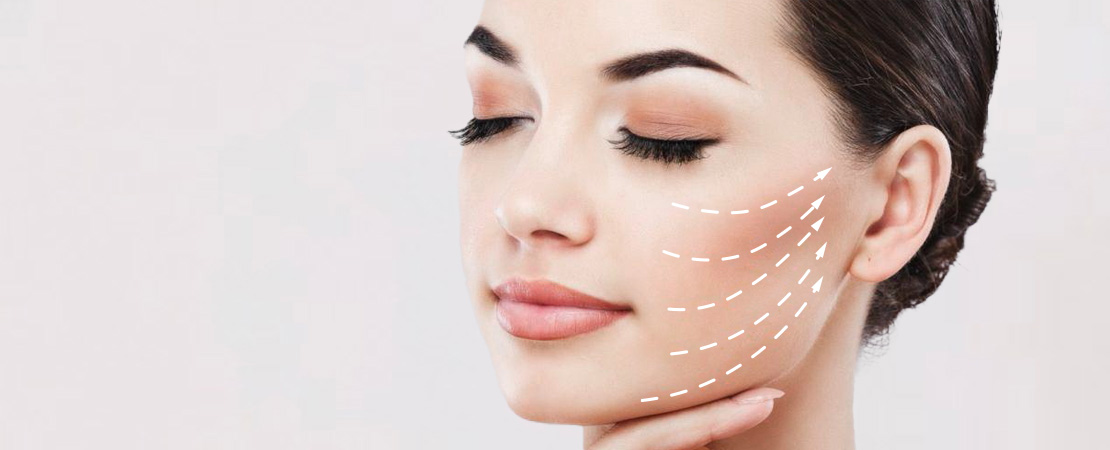 Круговая подтяжка лица