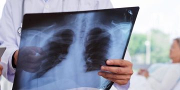 На Канівщині зростає кількість пневмоній | Про Все | Новини Черкас та Черкаської області | Про Все | Новини Черкас та Черкаської області